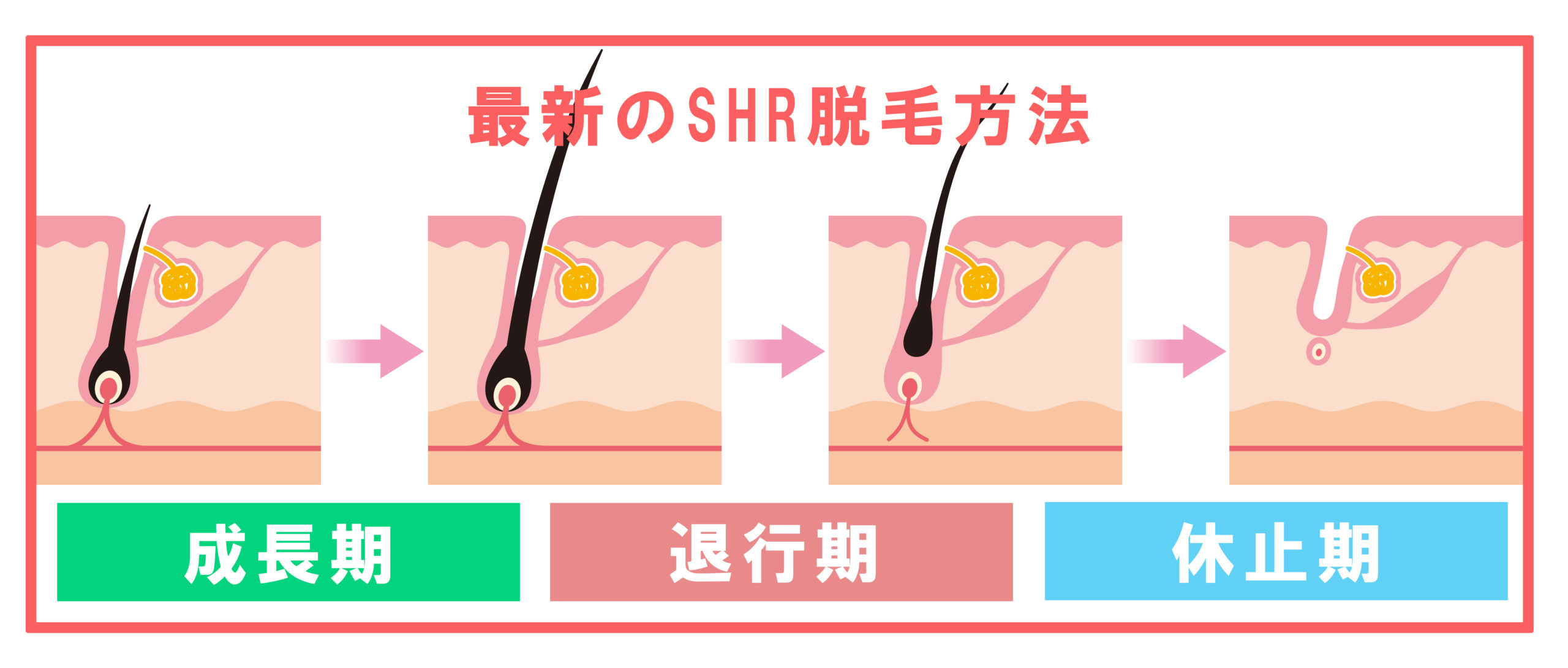 mousyuuki-shr