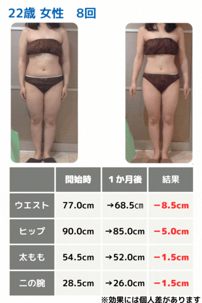 ２２歳女性ビフォアフ