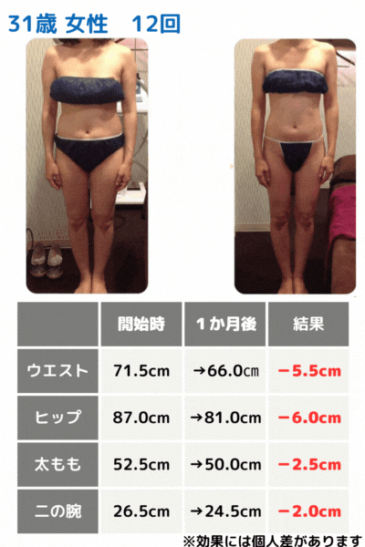 31歳女性ビフォアフ