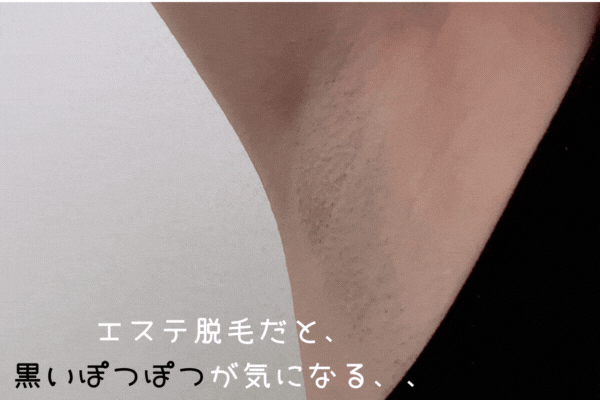 脇ぽつぽつ