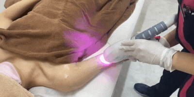 施術腕