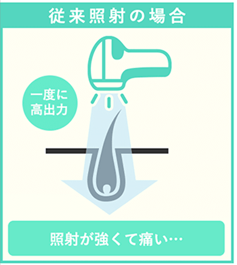 旧型レーザー