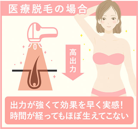 医療脱毛