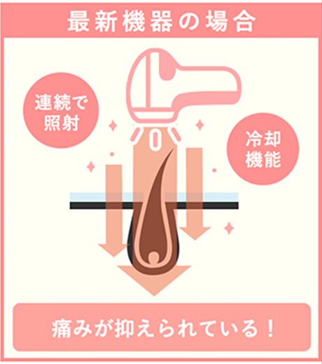 新型レーザー