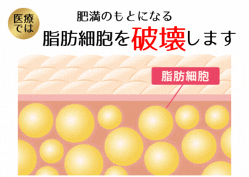 脂肪細胞破壊