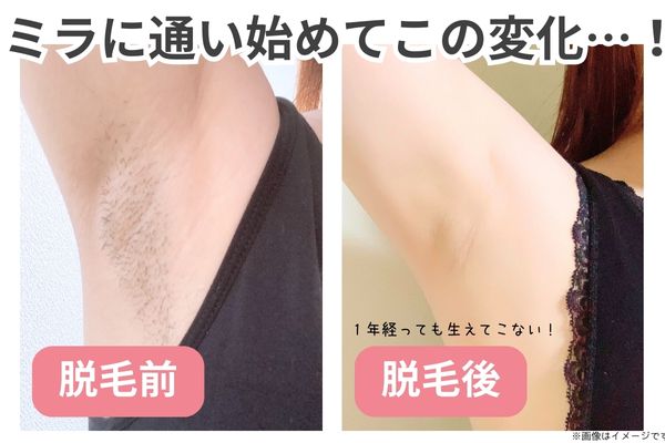 １年経っても生えてこない