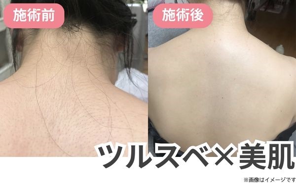 背中BA