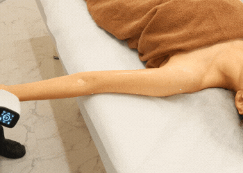 腕施術