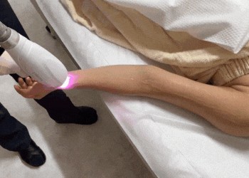 腕施術