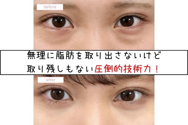 圧倒的技術力 width=