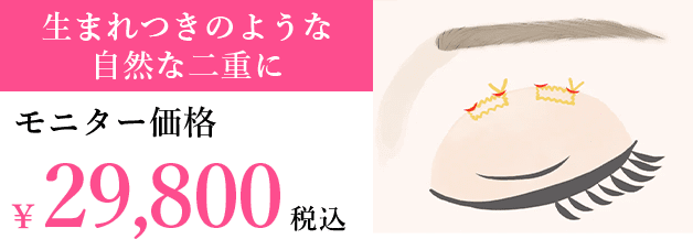 金額