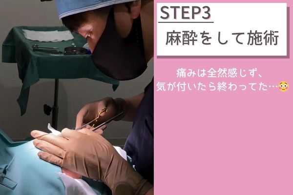 施術
