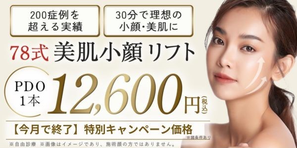 金額