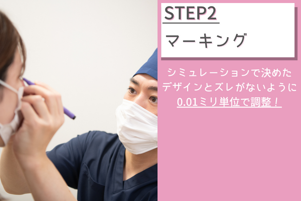 マーキング