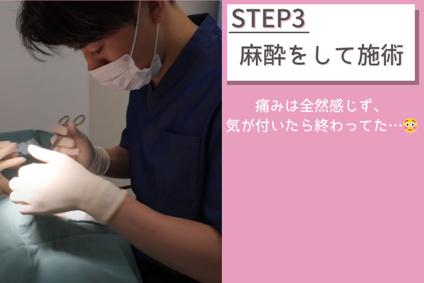 施術