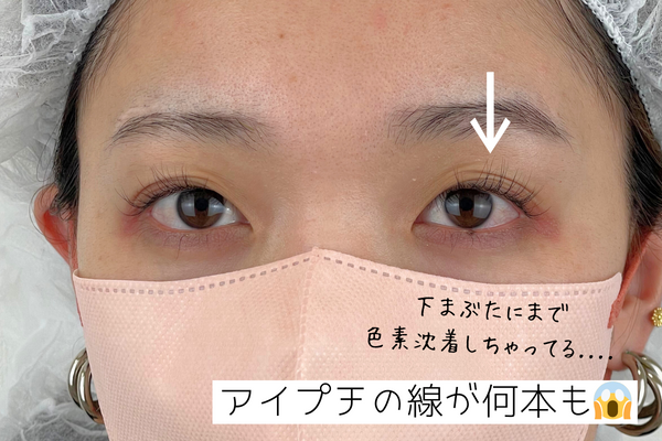 重い瞼