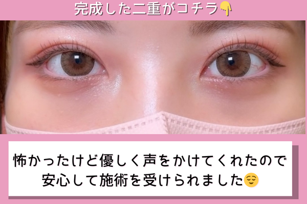 完成した二重