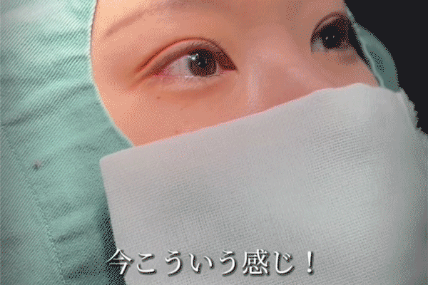 術直後も腫れていない